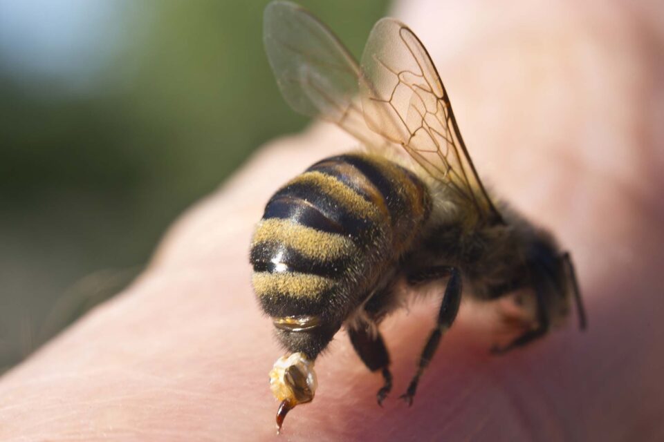 5 consigli per punture di ape